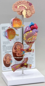 Hypertension Model Set Pharmaceutical and Anatomical Model Gifts